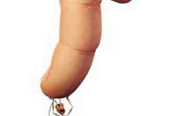 Μυρμήγκια : αντιμετωπίστε τα με οικολογικούς τρόπους